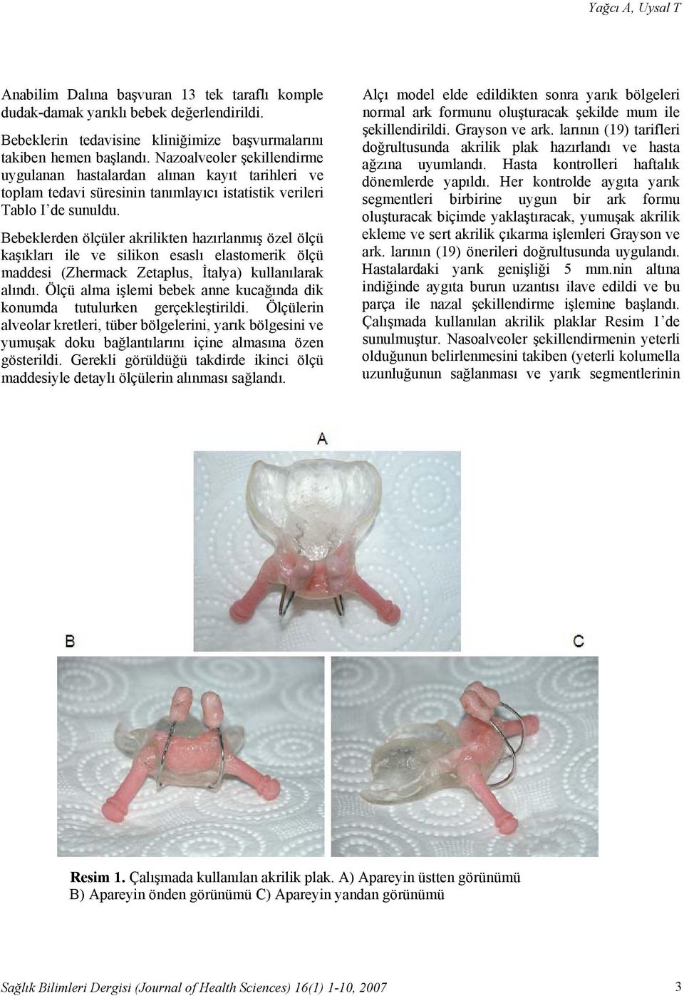 Bebeklerden ölçüler akrilikten hazırlanmış özel ölçü kaşıkları ile ve silikon esaslı elastomerik ölçü maddesi (Zhermack Zetaplus, İtalya) kullanılarak alındı.