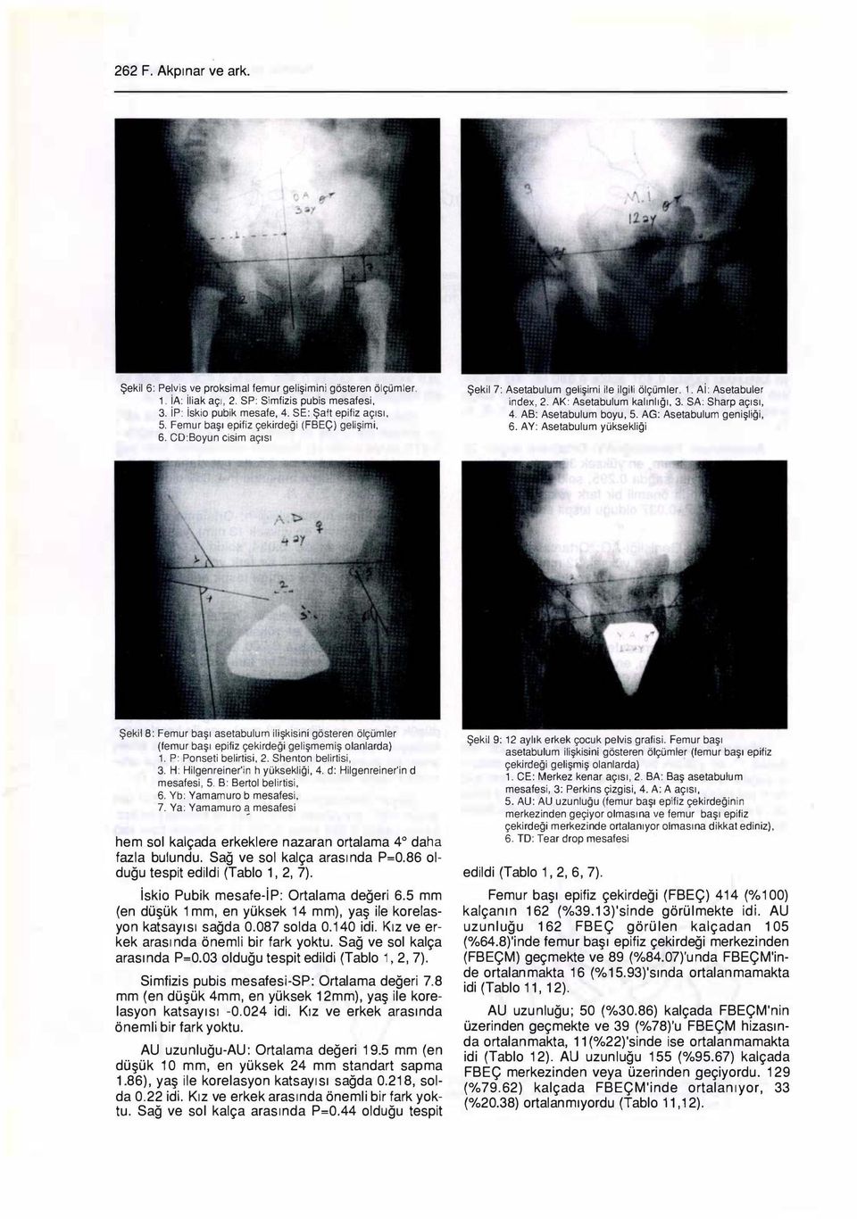 AB: Asetabulum boyu, 5. AG: Asetabulum genişliği, 6. AY: Asetabulum yüksekliği Şekil 8: Femur başı asetabulum ilişkisini gösteren ölçümler (femur başı epifiz çekirdeği gelişmemiş olanlarda) 1.