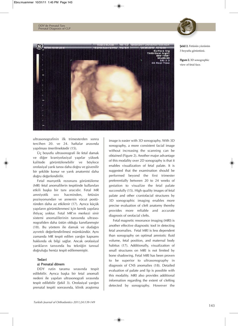 Üç boyutlu ultrasonografi ile fetal damak ve diğer kraniyofasiyal yapılar yüksek kalitede görüntülenebilir ve böylece orofasiyal yarık tanısı daha doğru ve güvenilir bir şekilde konur ve yarık