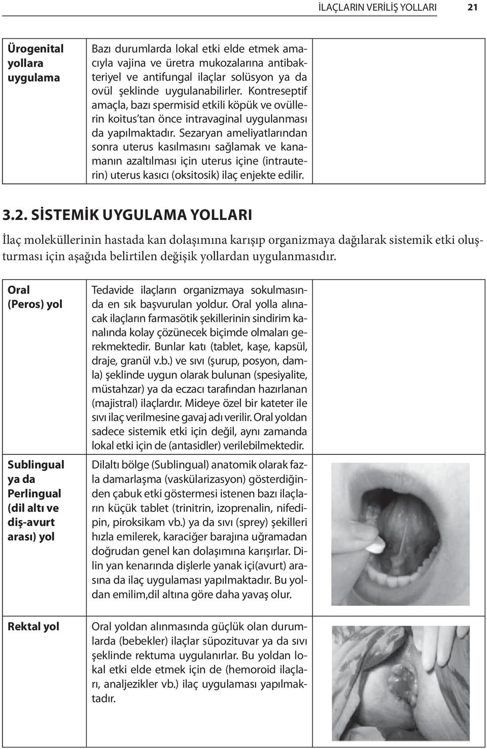 Sezaryan ameliyatlarından sonra uterus kasılmasını sağlamak ve kanamanın azaltılması için uterus içine (intrauterin) uterus kasıcı (oksitosik) ilaç enjekte edilir. 3.2.