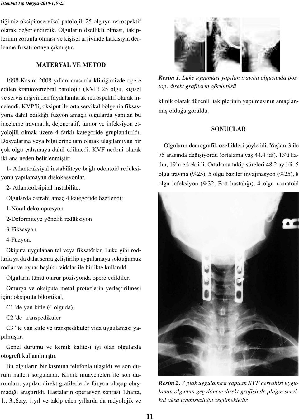 MATERYAL VE METOD 1998-Kas m 2008 y llar aras nda klini imizde opere edilen kraniovertebral patolojili (KVP) 25 olgu, kiflisel ve servis arflivinden faydalan larak retrospektif olarak incelendi.