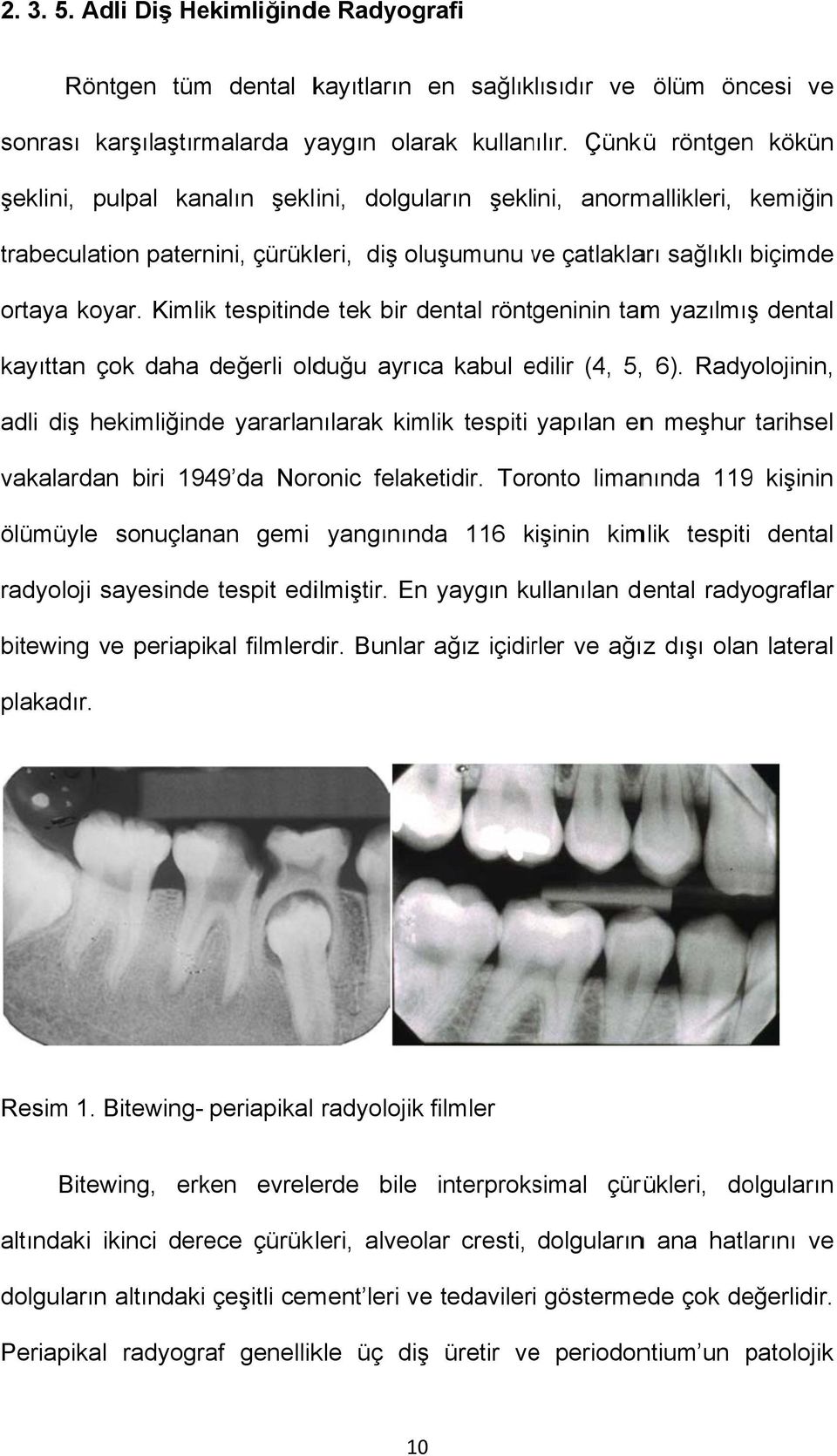 Kimlik tespitinde tek bir dental röntgeninin tamm yazılmışş dental kayıttan çok daha değerli olduğu ayrıca kabul edilir e (4, 5,, 6).