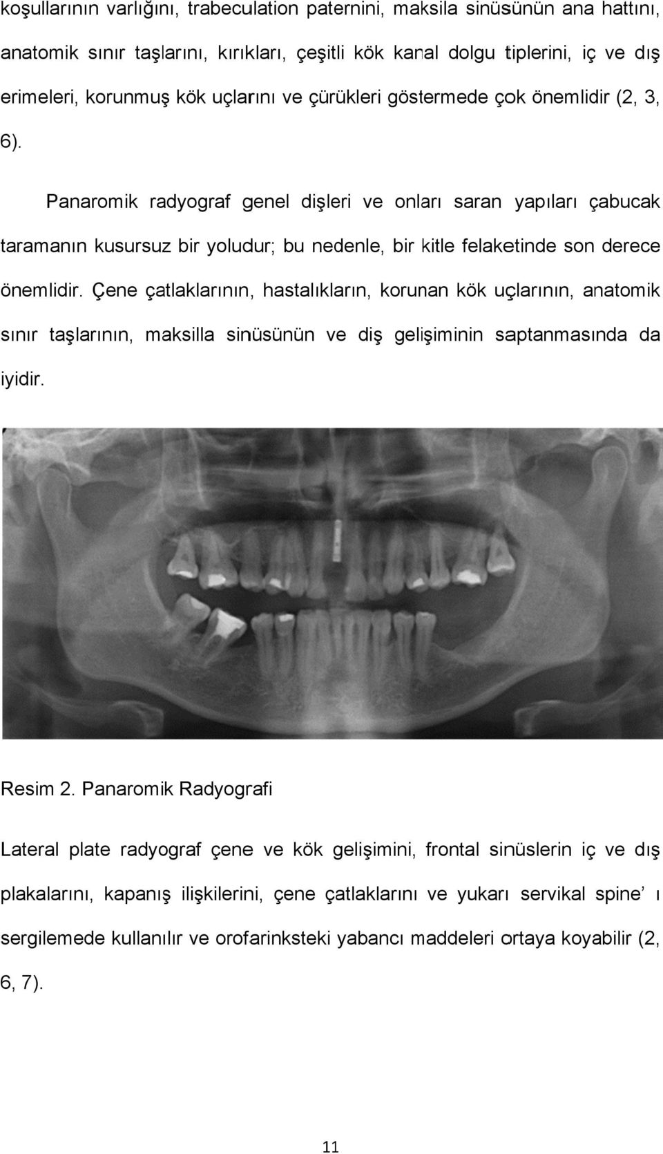 Çene çatlaklarının, hastalıkların, korunan kök uçlarının, anatomik sınır taşlarının, maksilla sinüsünün ve diş gelişiminin saptanmasında da iyidir. Resim 2.