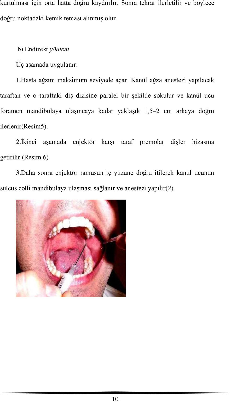 Kanül ağza anestezi yapılacak taraftan ve o taraftaki diş dizisine paralel bir şekilde sokulur ve kanül ucu foramen mandibulaya ulaşıncaya kadar yaklaşık