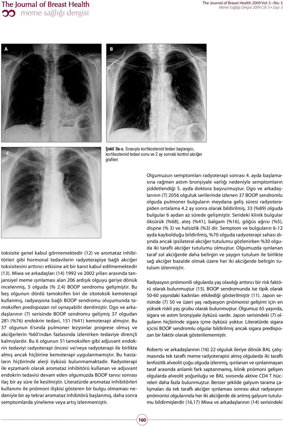 tedavilerin radyoterapiye bağlı akciğer toksisitesini arttırıcı etkisine ait bir kanıt kabul edilmemektedir (13).