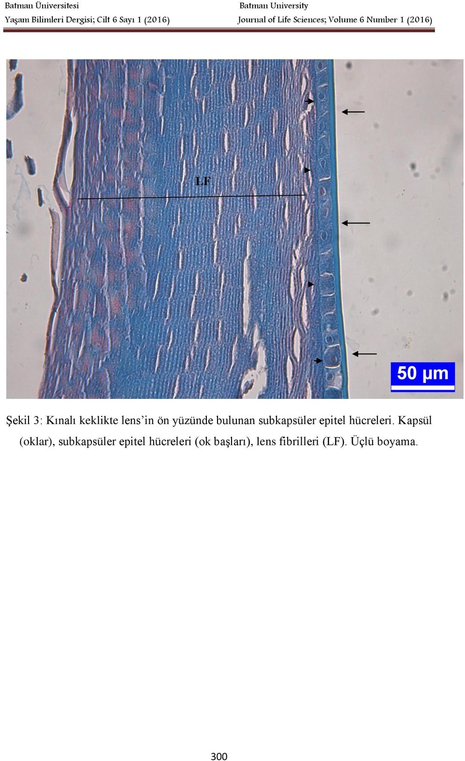 Kapsül (oklar), subkapsüler epitel hücreleri