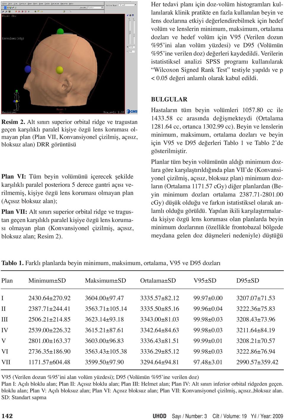 Verilerin istatistiksel analizi SPSS programı kullanılarak Wilcoxon Signed Rank Test testiyle yapıldı ve p < 0.05 değeri anlamlı olarak kabul edildi. Resim 2.