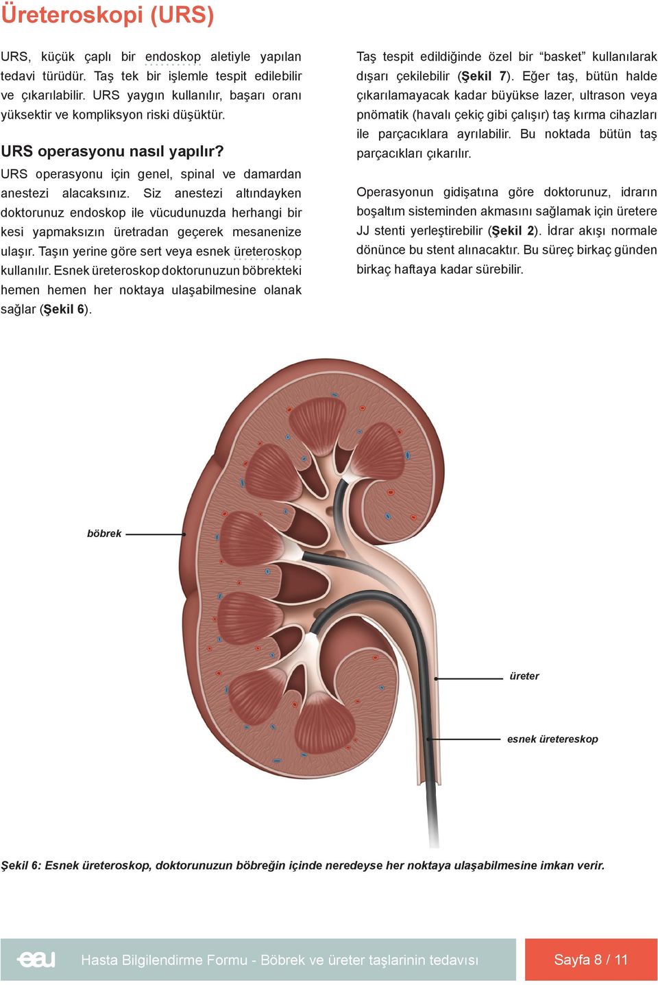 Siz anestezi altındayken doktorunuz endoskop ile vücudunuzda herhangi bir kesi yapmaksızın üretradan geçerek mesanenize ulaşır. Taşın yerine göre sert veya esnek üreteroskop kullanılır.