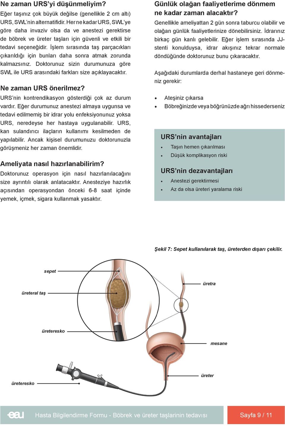 İşlem sırasında taş parçacıkları çıkarıldığı için bunları daha sonra atmak zorunda kalmazsınız. Doktorunuz sizin durumunuza göre SWL ile URS arasındaki farkları size açıklayacaktır.