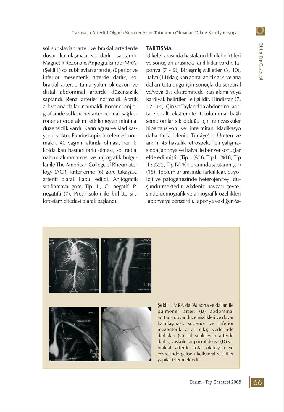 düzensizlik saptandı. Renal arterler normaldi. Aortik ark ve ana dalları normaldi. Koroner anjiografisinde sol koroner arter normal, sağ koroner arterde akımı etkilemeyen minimal düzensizlik vardı.