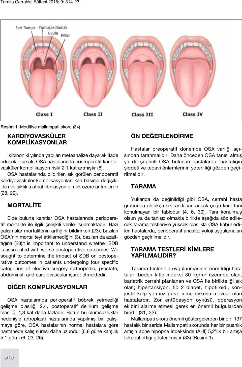 1 kat artmıştır (6). OSA hastalarında bildirilen sık görülen perioperatif kardiyovasküler komplikasyonlar: kan basıncı değişiklileri ve sıklıkla atrial fibrilasyon olmak üzere aritmilerdir (28, 29).