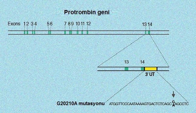 Şekil 8. Protrombin geninde G20210A mutasyonu. 20210. pozisyonunda, tek noktada Guanin in Adenin e dönüşümü PT geninde 3 değişmeyen bölgeyi etkilemektedir.