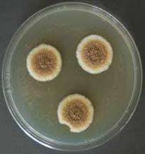 Aspergillus türleri Toprak Tohumlar Çayır/Çimen Hava Sular Kompost Havalandırma sistemlerinden