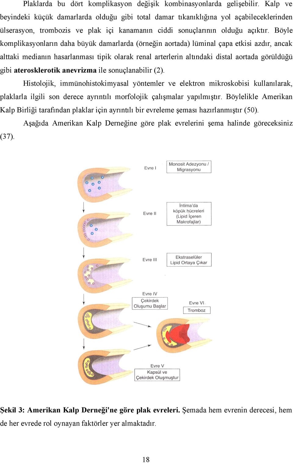 Böyle komplikasyonların daha büyük damarlarda (örneğin aortada) lüminal çapa etkisi azdır, ancak alttaki medianın hasarlanması tipik olarak renal arterlerin altındaki distal aortada görüldüğü gibi