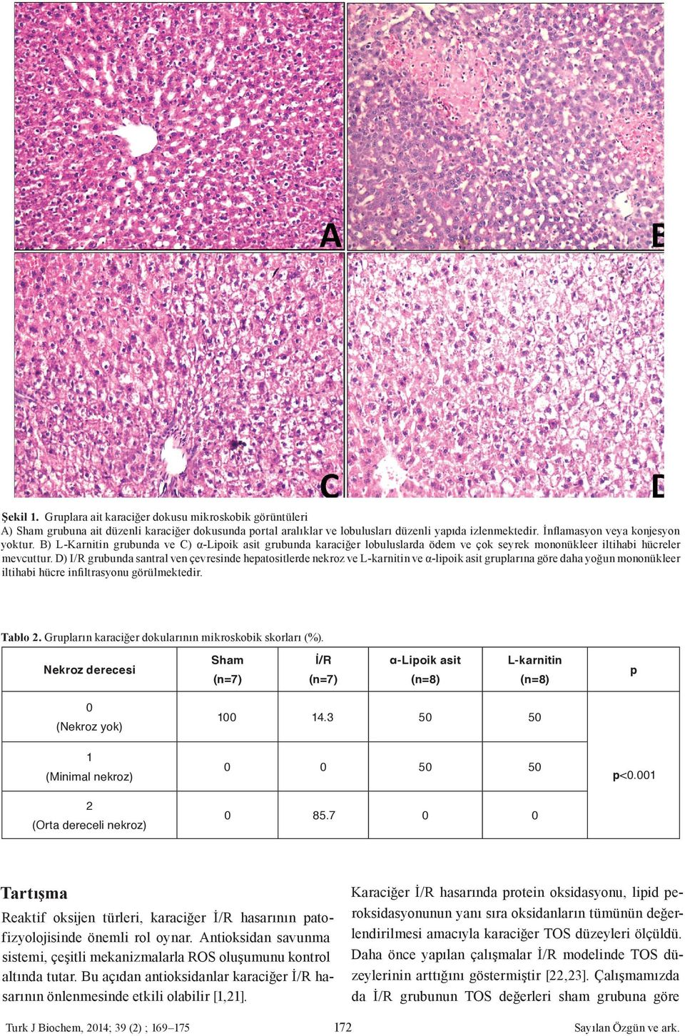 D) I/R grubunda santral ven çevresinde hepatositlerde nekroz ve L-karnitin ve α-lipoik asit gruplarına göre daha yoğun mononükleer iltihabi hücre infiltrasyonu görülmektedir. Tablo 2.