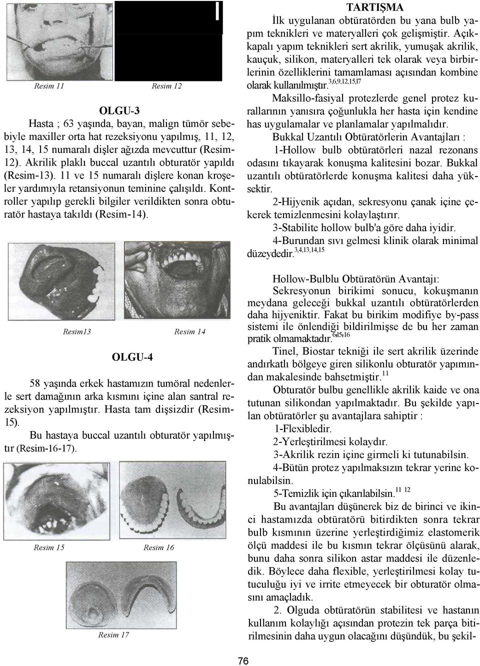 Kontroller yapılıp gerekli bilgiler verildikten sonra obturatör hastaya takıldı (Resim-14).