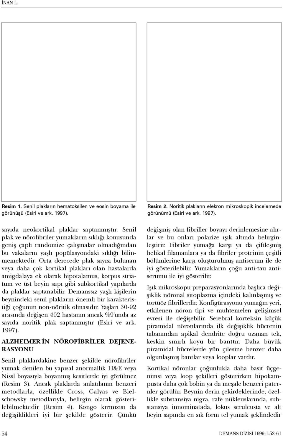 Orta derecede plak sayýsý bulunan veya daha çok kortikal plaklarý olan hastalarda amigdalaya ek olarak hipotalamus, korpus striatum ve üst beyin sapý gibi subkortikal yapýlarda da plaklar