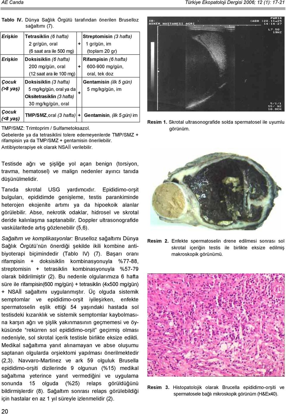 hafta) 200 mg/gün, oral + 600-900 mg/gün, (12 saat ara ile 100 mg) oral, tek doz Doksisiklin (3 hafta) Gentamisin (ilk 5 gün) 5 mg/kg/gün, oral ya da 5 mg/kg/gün, im + Oksitetrasiklin (3 hafta) 30