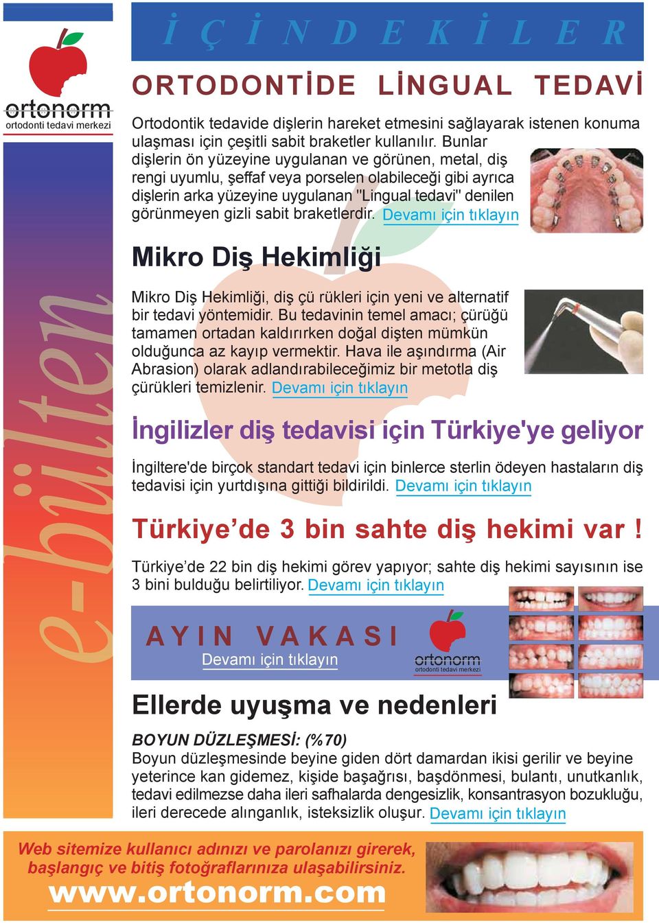 sabit braketlerdir. Devamı için tıklayın Mikro Diş Hekimliği Mikro Diş Hekimliği, diş çü rükleri için yeni ve alternatif bir tedavi yöntemidir.