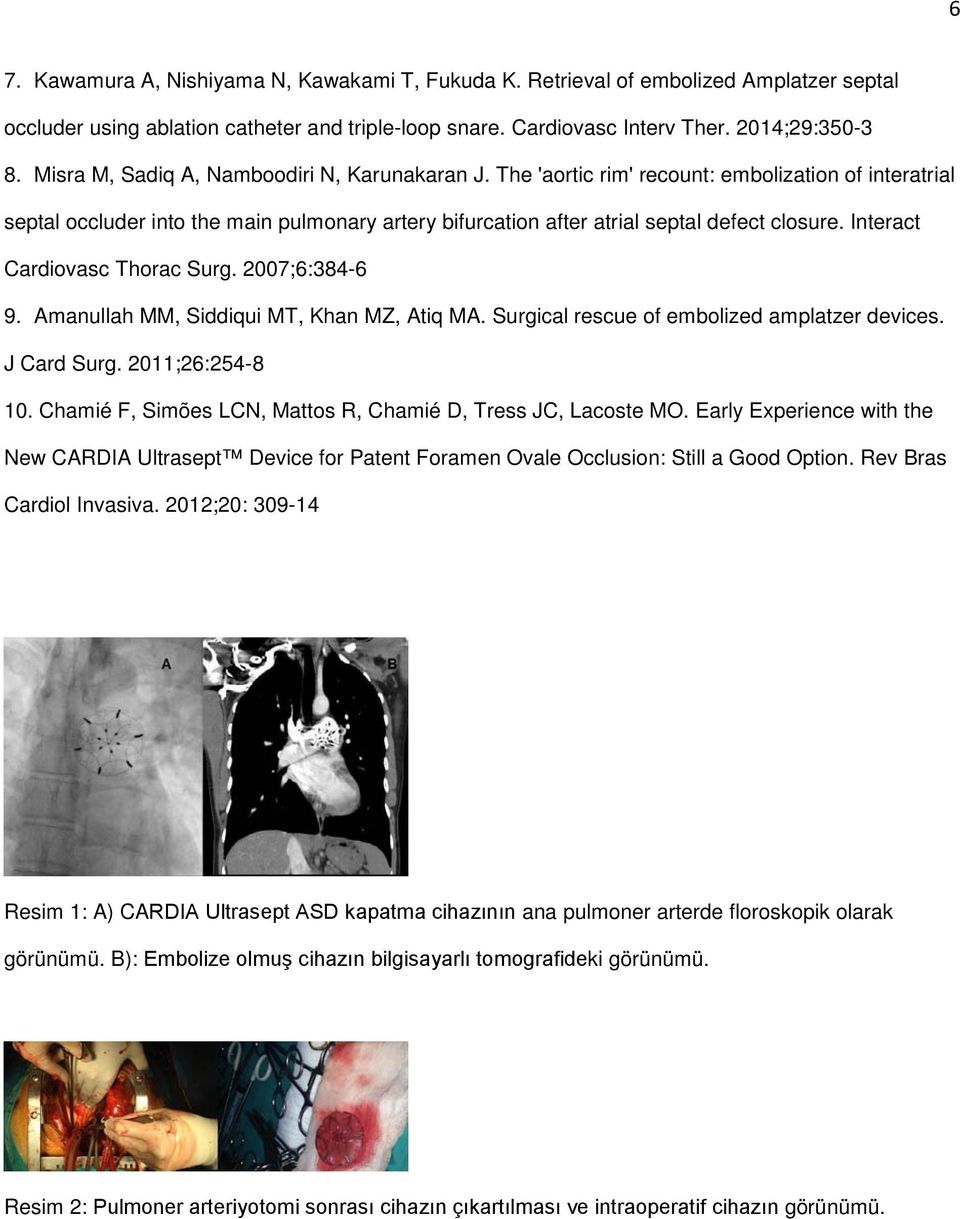 Interact Cardiovasc Thorac Surg. 2007;6:384-6 9. Amanullah MM, Siddiqui MT, Khan MZ, Atiq MA. Surgical rescue of embolized amplatzer devices. J Card Surg. 2011;26:254-8 10.