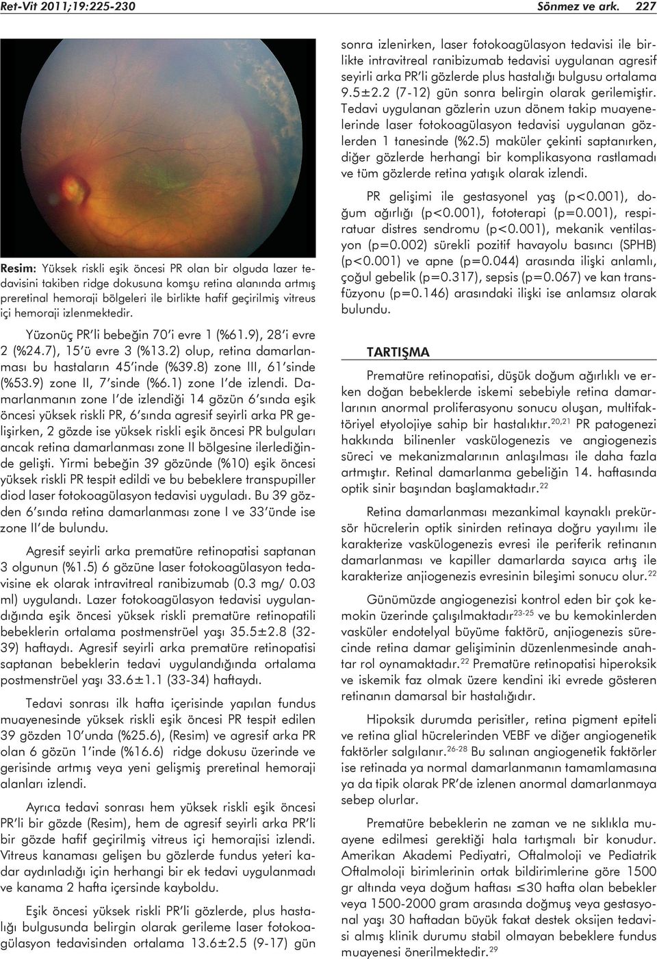 hemoraji izlenmektedir. Yüzonüç PR li bebeğin 70 i evre 1 (%61.9), 28 i evre 2 (%24.7), 15 ü evre 3 (%13.2) olup, retina damarlanması bu hastaların 45 inde (%39.8) zone III, 61 sinde (%53.