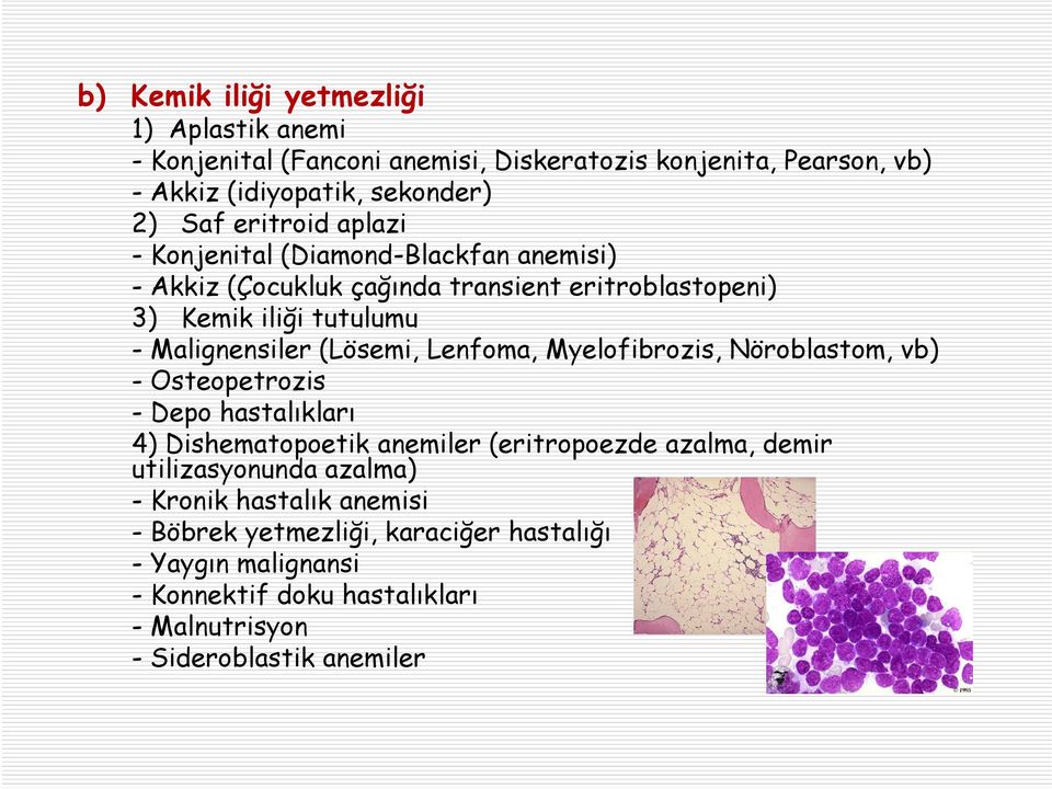 (Lösemi, Lenfoma, Myelofibrozis, Nöroblastom, vb) - Osteopetrozis -Depo hastalıkları 4) Dishematopoetik anemiler (eritropoezde azalma, demir