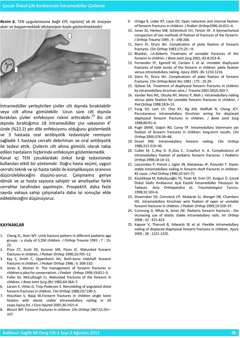 gömülebilir. Uzun süre cilt dışında bırakılan çiviler enfeksiyon riskini arttırabilir. 25 Biz cilt dışında bıraktığımız 18 intramedüller çivi vakasının 4 ünde (%22.