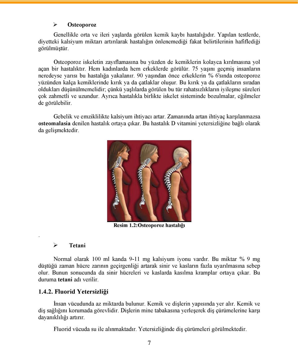 Osteoporoz iskeletin zayıflamasına bu yüzden de kemiklerin kolayca kırılmasına yol açan bir hastalıktır. Hem kadınlarda hem erkeklerde görülür.