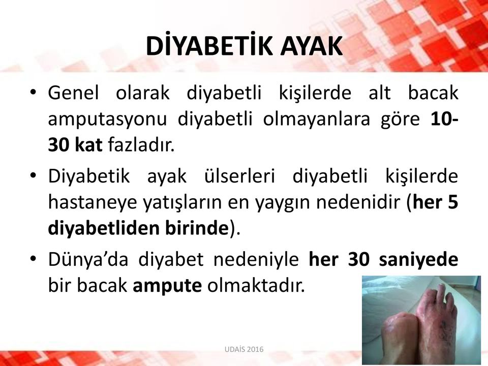 Diyabetik ayak ülserleri diyabetli kişilerde hastaneye yatışların en yaygın