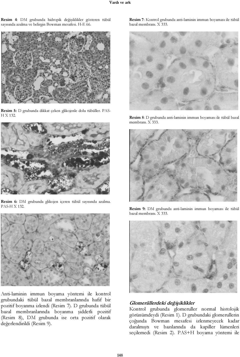 Resim 8: D grubunda anti-laminin immun boyaması ile tübül bazal membranı. X 333. Resim 6: DM grubunda glikojen içeren tübül sayısında azalma. PAS-H X 132.