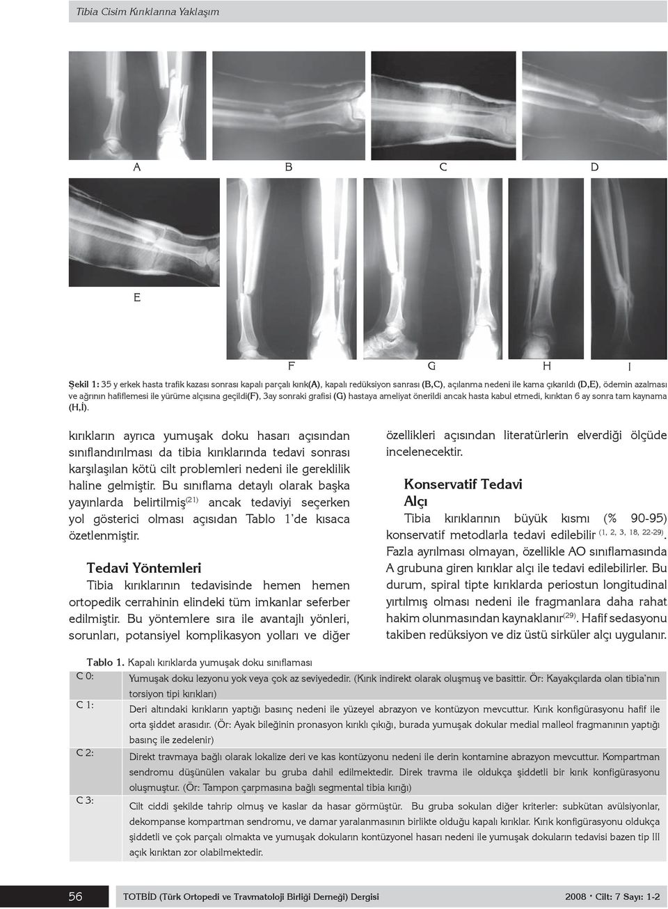 kırıkların ayrıca yumuşak doku hasarı açısından sınıflandırılması da tibia kırıklarında tedavi sonrası karşılaşılan kötü cilt problemleri nedeni ile gereklilik haline gelmiştir.