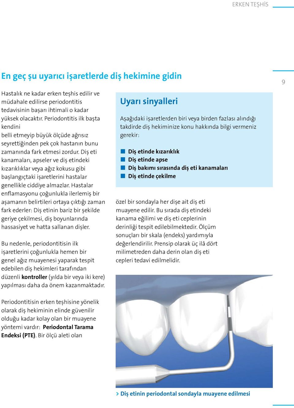 Diş eti kanamaları, apseler ve diş etindeki kızarıklıklar veya ağız kokusu gibi başlangıçtaki işaretlerini hastalar genellikle ciddiye almazlar.