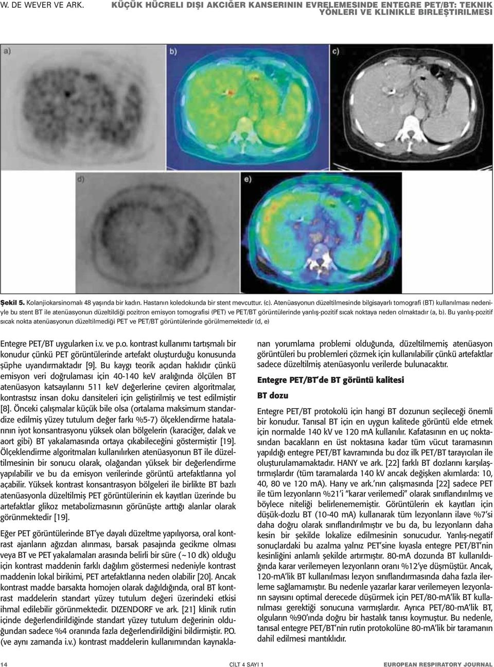 sıcak noktaya neden olmaktadır (a, b). Bu yanlış-pozitif sıcak nokta atenüasyonun düzeltilmediği PET ve PET/BT görüntülerinde görülmemektedir (d, e) Entegre PET/BT uygularken i.v. ve p.o. kontrast kullanımı tartışmalı bir konudur çünkü PET görüntülerinde artefakt oluşturduğu konusunda şüphe uyandırmaktadır [9].