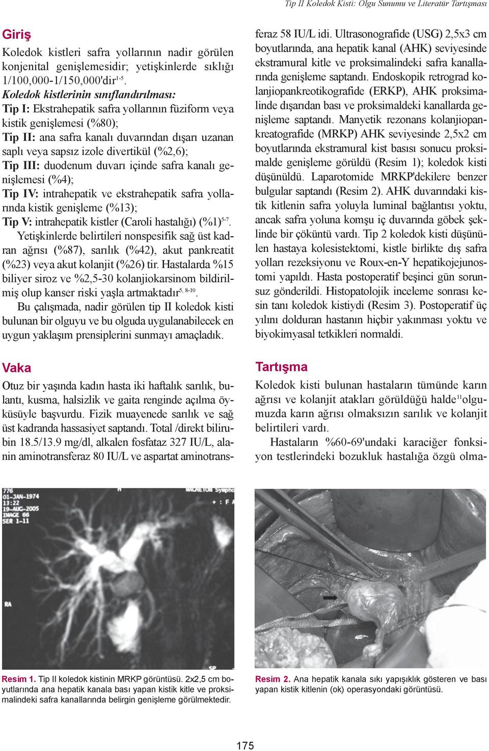 divertikül (%2,6); Tip III: duodenum duvarý içinde safra kanalý geniþlemesi (%4); Tip IV: intrahepatik ve ekstrahepatik safra yollarýnda kistik geniþleme (%13); Tip V: intrahepatik kistler (Caroli