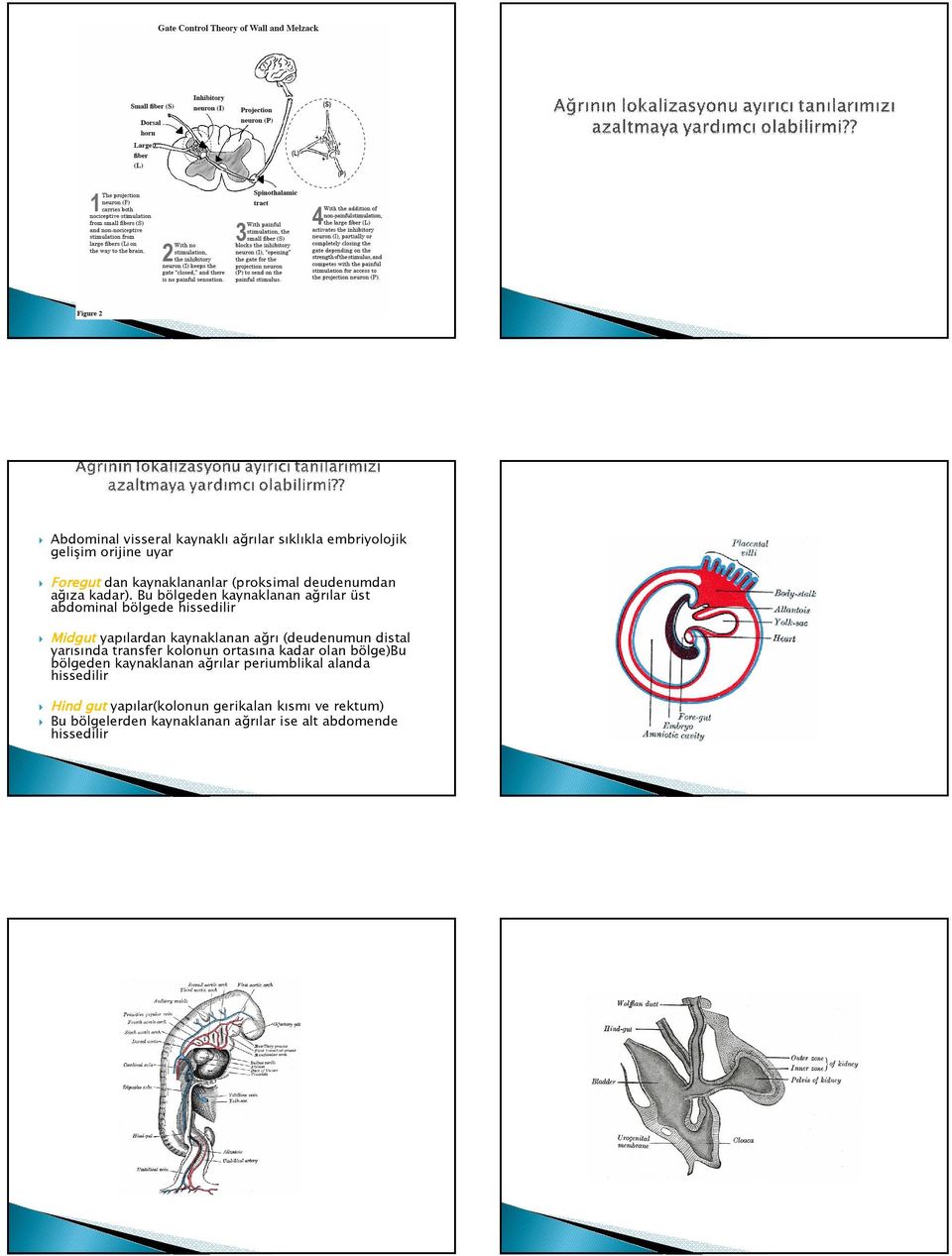 Bu bölgeden kaynaklanan ağrılar üst abdominal bölgede hissedilir Midgut yapılardan kaynaklanan ağrı (deudenumun distal