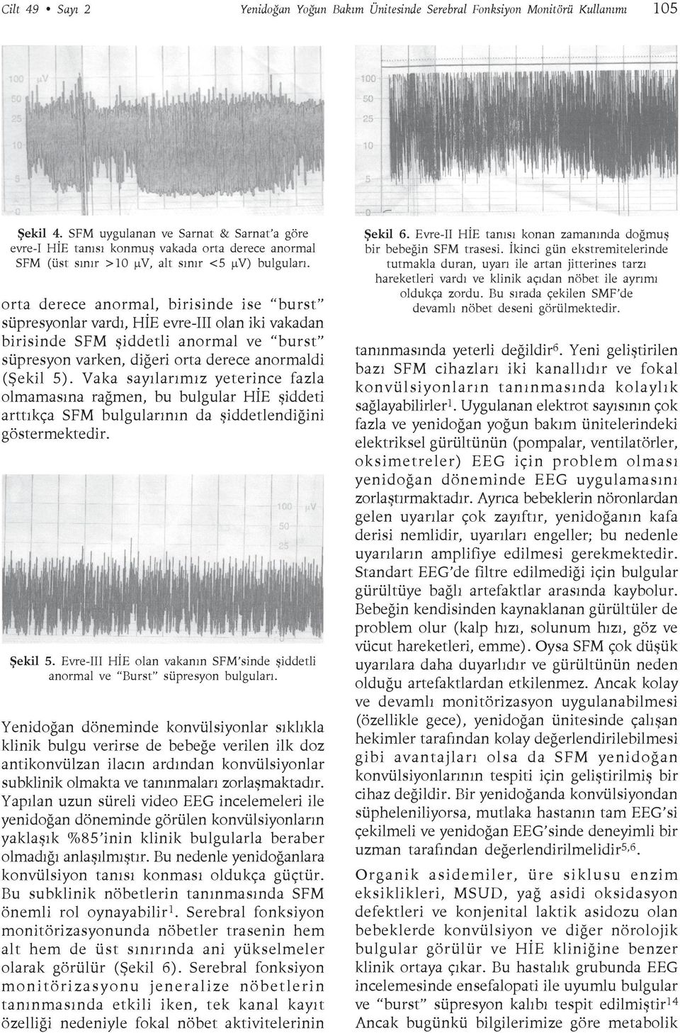 orta derece anormal, birisinde ise burst süpresyonlar vardı, HİE evre-iii olan iki vakadan birisinde SFM şiddetli anormal ve burst süpresyon varken, diğeri orta derece anormaldi (Şekil 5).