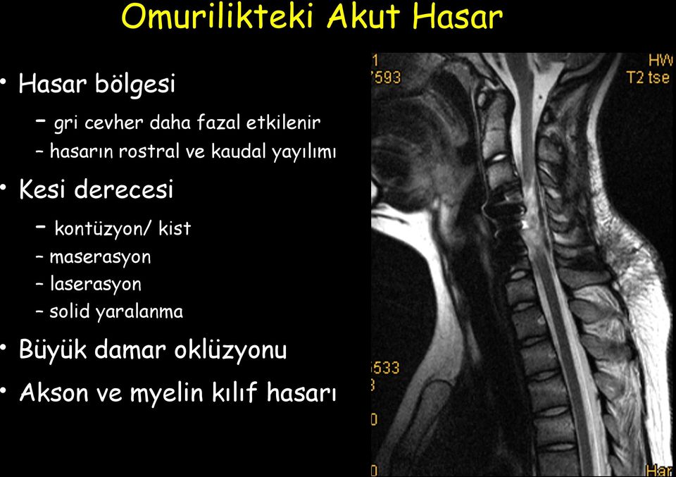 derecesi kontüzyon/ kist maserasyon laserasyon solid