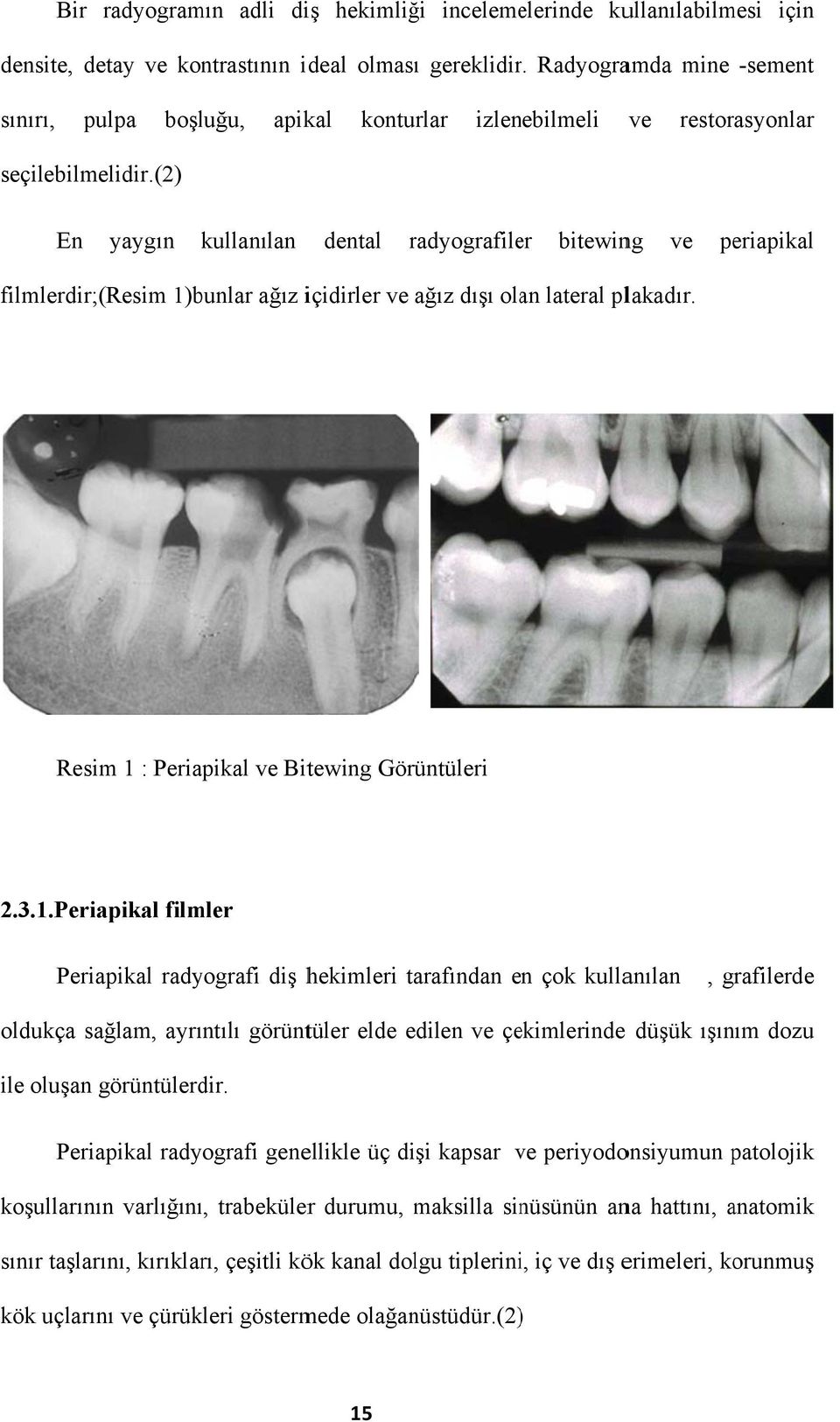 (2) En yaygın kullanılan dental radyografile er bitewing ve periapikal filmlerdir; ;(Resim 1)bunlar ağız içidirler ve ağız dışı olan lateral plakadır. Resim 1 : Periapikal ve Bitewing Görüntüleri 2.3.