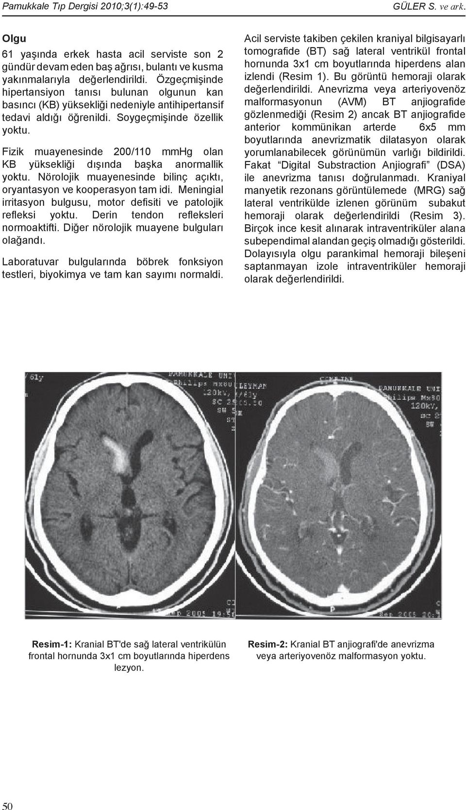 Fizik muayenesinde 200/110 mmhg olan KB yüksekliği dışında başka anormallik yoktu. Nörolojik muayenesinde bilinç açıktı, oryantasyon ve kooperasyon tam idi.