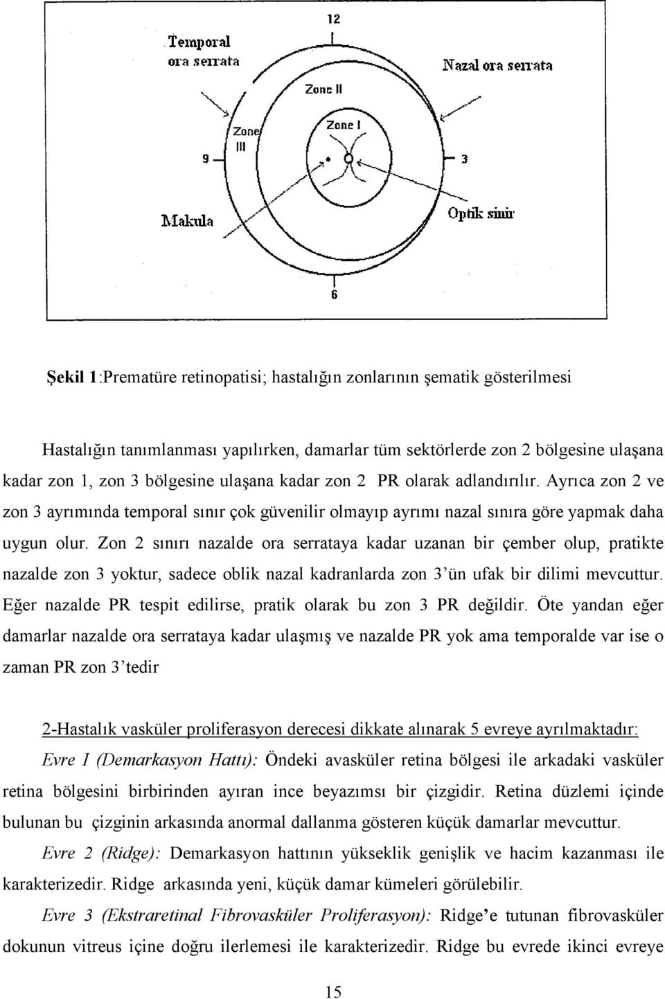 Ayr6ca zon 2 ve zon 3 ayr6m6nda temporal s6n6r çok güvenilir olmay6p ayr6m6 nazal s6n6ra göre yapmak daha uygun olur.