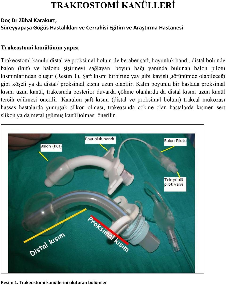 Şaft kısmı birbirine yay gibi kavisli görünümde olabileceği gibi köşeli ya da distal/ proksimal kısmı uzun olabilir.