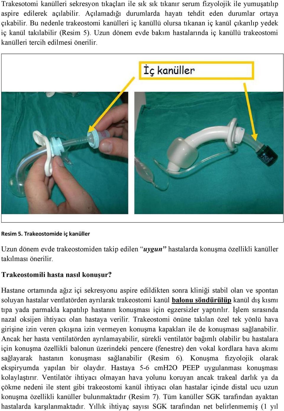 Uzun dönem evde bakım hastalarında iç kanüllü trakeostomi kanülleri tercih edilmesi önerilir. Resim 5.