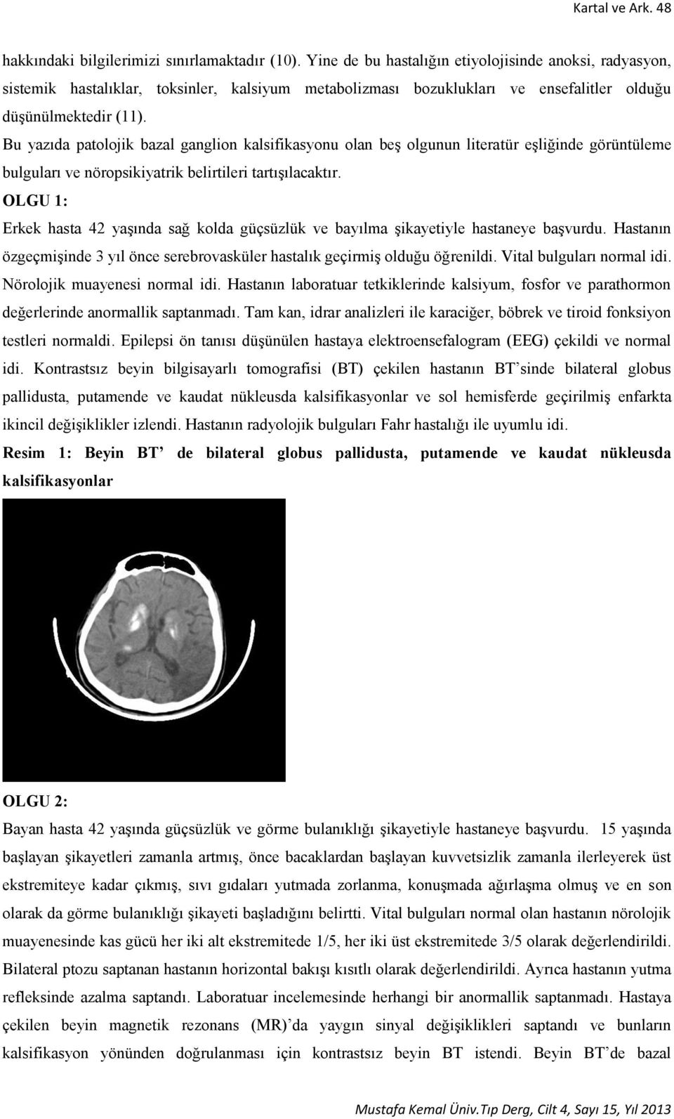 Bu yazıda patolojik bazal ganglion kalsifikasyonu olan beş olgunun literatür eşliğinde görüntüleme bulguları ve nöropsikiyatrik belirtileri tartışılacaktır.