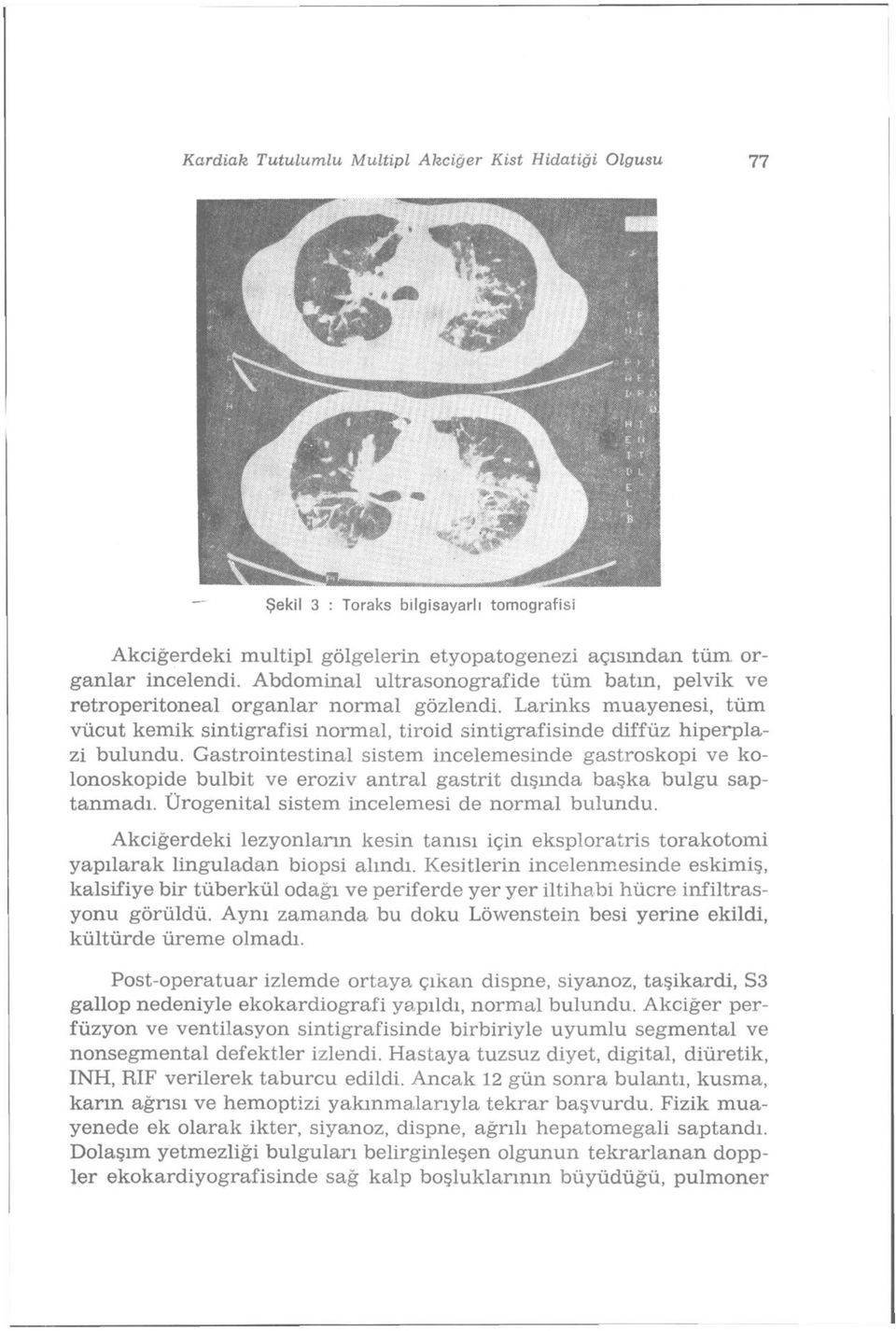 Gastrointestinal sistem incelemesinde gastroskopi ve kolonoskopide bulbit ve eroziv antral gastrit dışında başka bulgu saptanmadı. Ürogenital sistem incelemesi de normal bulundu.