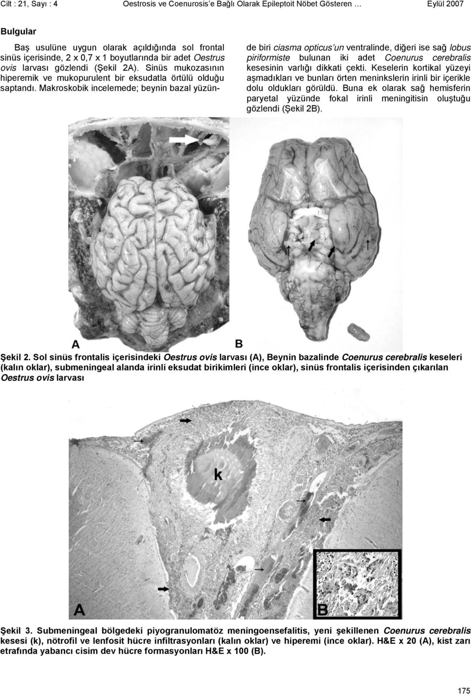 Makroskobik incelemede; beynin bazal yüzün- de biri ciasma opticus un ventralinde, diğeri ise sağ lobus piriformiste bulunan iki adet Coenurus cerebralis kesesinin varlığı dikkati çekti.