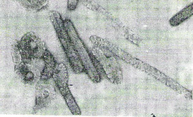 İkozahedral Simetrili virus Helikal