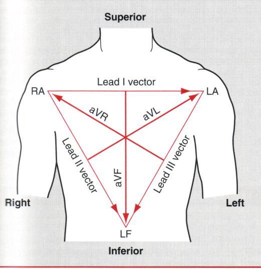 ekg değerlendirme Üst RA: sağ kol LA: sol kol - Derivasyon I +