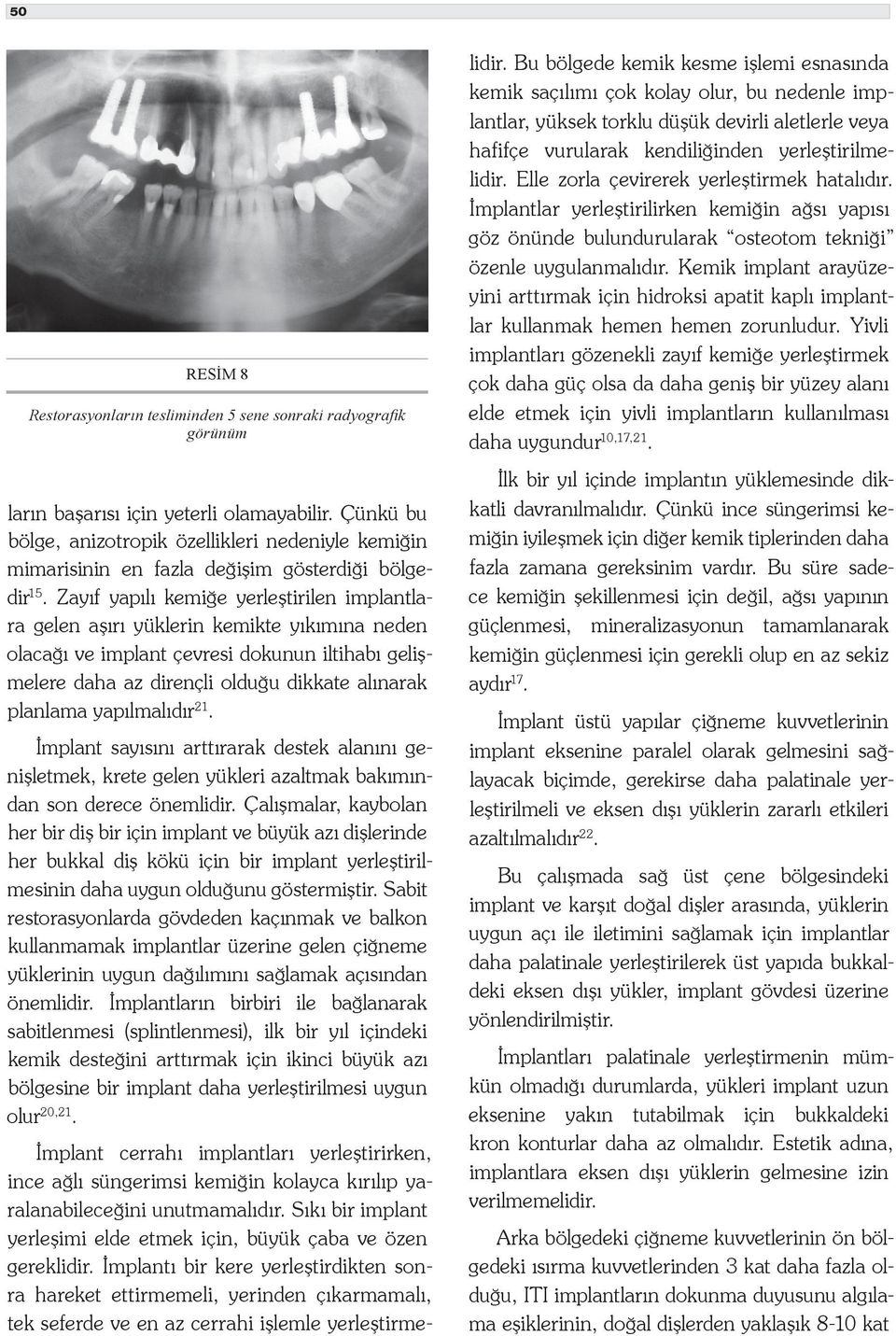 Zayıf yapılı kemiğe yerleştirilen implantlara gelen aşırı yüklerin kemikte yıkımına neden olacağı ve implant çevresi dokunun iltihabı gelişmelere daha az dirençli olduğu dikkate alınarak planlama