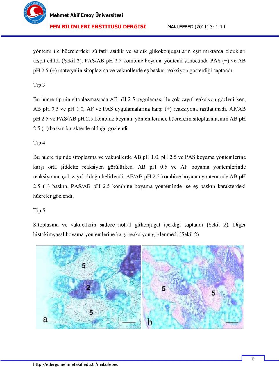 0, AF ve PAS uygulamalarına karşı (+) reaksiyona rastlanmadı. AF/AB ph 2.5 ve PAS/AB ph 2.5 kombine boyama yöntemlerinde hücrelerin sitoplazmasının AB ph 2.5 (+) baskın karakterde olduğu gözlendi.