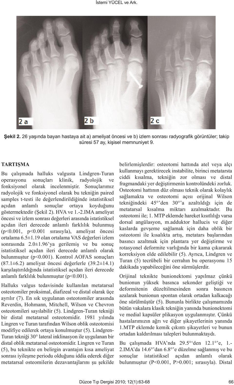 Sonuçlarımız radyolojik ve fonksiyonel olarak bu tekniğin paired samples t-testi ile değerlendirildiğinde istatistiksel açıdan anlamlı sonuçlar ortaya koyduğunu göstermektedir (Şekil 2). HVA ve 1.-2.